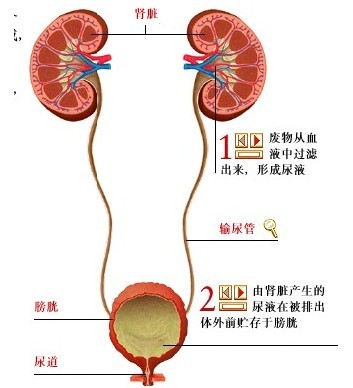 尿結(jié)石病因