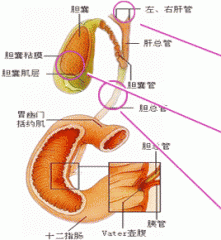 膽管結(jié)石的癥狀及早了解，及時發(fā)現(xiàn)病情