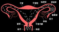 先天性子宮發(fā)育不良怎么治療?