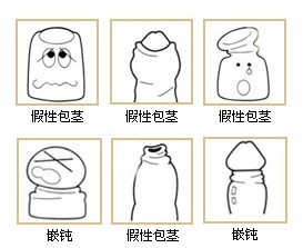 包皮過(guò)長(zhǎng)如何判斷？