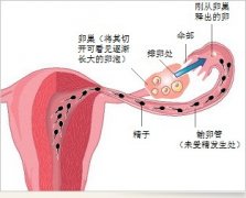 專(zhuān)家支招：6招助你預(yù)防卵巢“提早下崗”