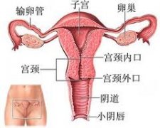 宮頸肥大是誘發(fā)女性不孕的背后黑手